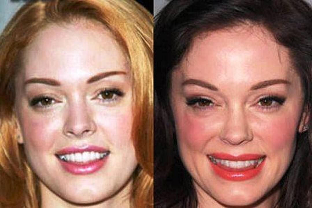 Plastinės chirurgijos nesėkmės. Tai ar verta?
