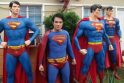 Vyras iškentė kelias operacijas, kad būtų panašus į Supermeną