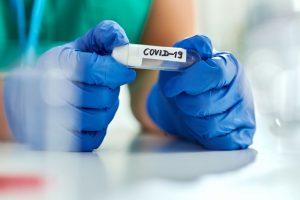 COVID-19 statistika: 72 nauji atvejai, mirčių nefiksuota