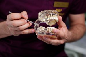 „Šypsenos akademijoje“ –  itin žemos dantų implantacijos kainos
