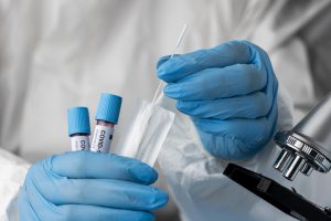 COVID-19 statistika: 65 nauji atvejai, vienas žmogus mirė