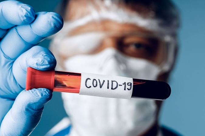 COVID-19 statistika: 77 nauji atvejai, dvi mirtys