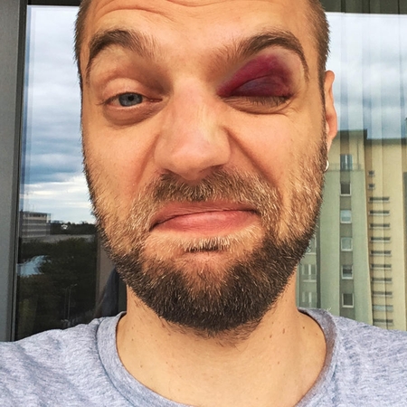 Nesurežisuota: T. Vidmantas gavo į akį už šokį su svetima mergina