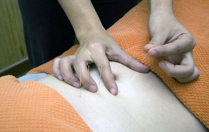 Asociatyvi nuotr.