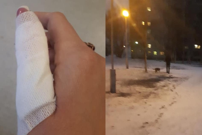 Apkandžiotai kaunietei augintinio šeimininkas atrėžė: mano šuo geras, paskiepytas