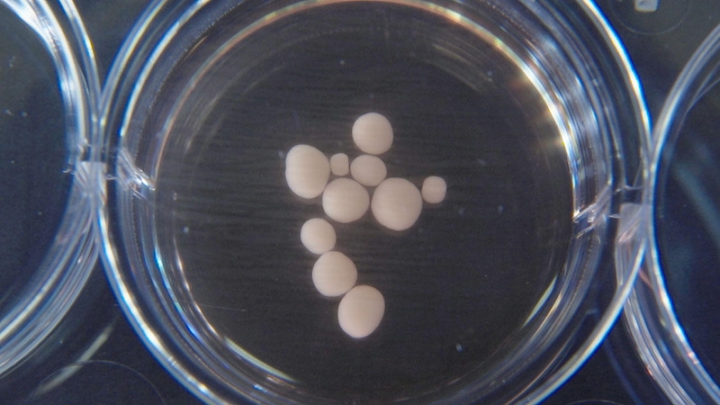 Laboratorijoje išaugintose smegenyse užfiksuoti žmonėms būdingi impulsai