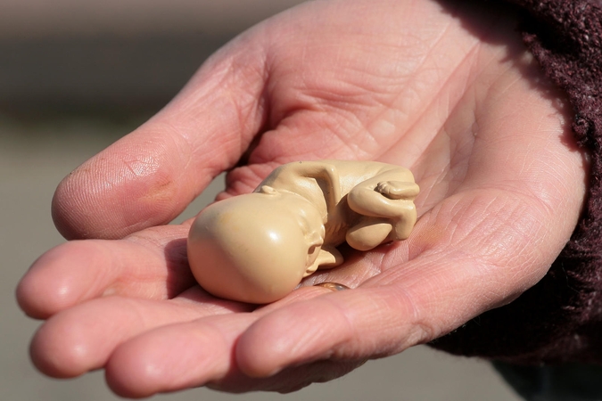 Abortą pasidariusi moteris: tai sukuria labai daug problemų
