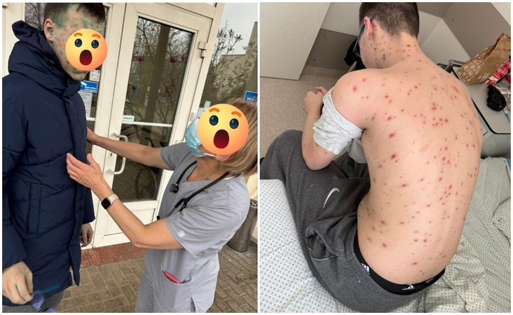 „Nesuvokiama situacija“: medikė stipriai karščiuojantį ir išbertą paauglį apžiūrėjo lauke