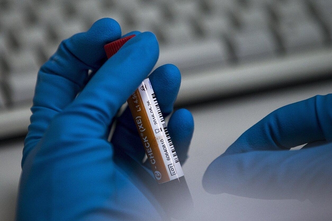 WADA patvirtino gavusi Rusijos atsakymus apie Maskvos antidopingo laboratoriją
