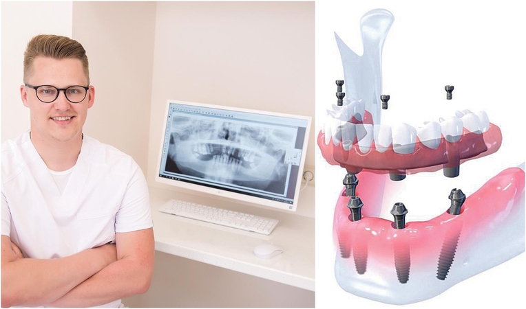 Konsultacija: gyd. odontologas – burnos chirurgas G.Doviltis.