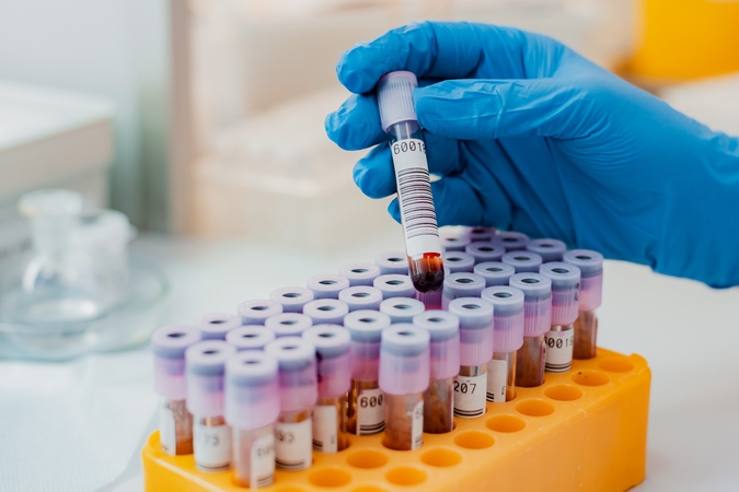 Laboratorijos vadovas: Lietuvoje plečiami tyrimai dėl koronaviruso mutacijų