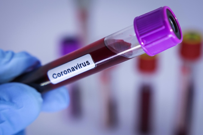 Koronavirusas sostinėje: užsikrėtė vyras ir moteris, keliavę po Europą