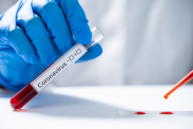 Prokuratūra prašo iš bendrovių priteisti per 4 mln. eurų už greituosius COVID-19 testus