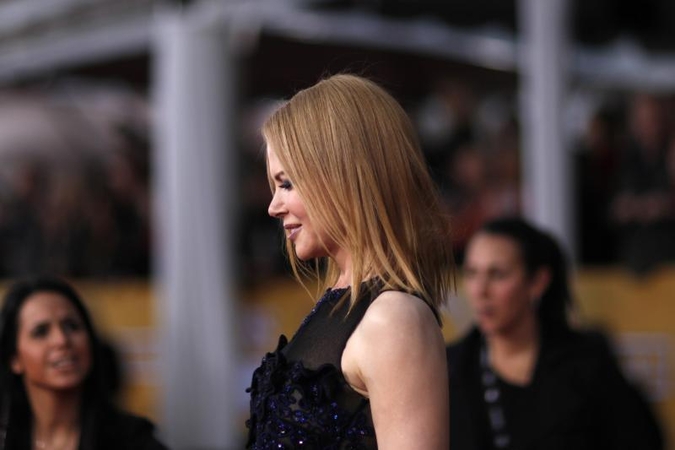 N. Kidman išbandė botulino injekcijas (foto)