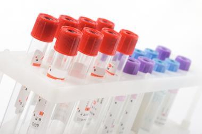Vilniaus rajone atidaromos chemijos laboratorijos