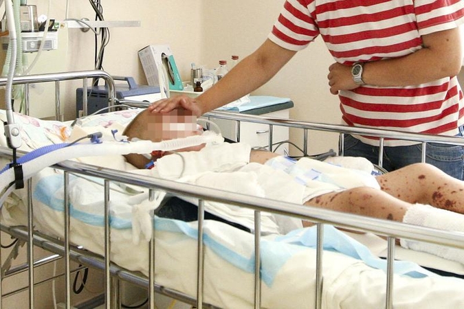 Infekcijos nukamuoto mažylio laukia dar vienas išbandymas – amputacija