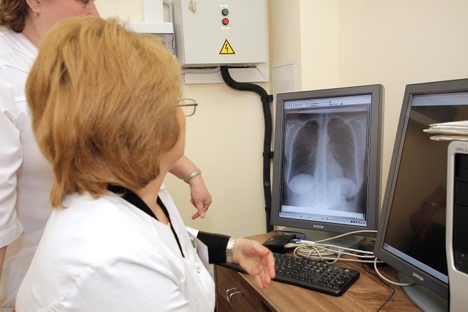 Gripo epidemiją pakeis tuberkuliozės protrūkis?